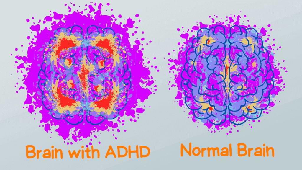 screenshot graphics brain with adhd vs normal brain themba tutors