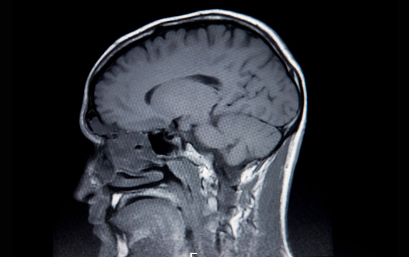 brain imaging techniques